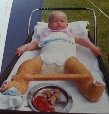 Kind in gipsbroek in wandelwagen