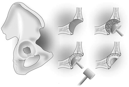 Werkwijze Radboudumc